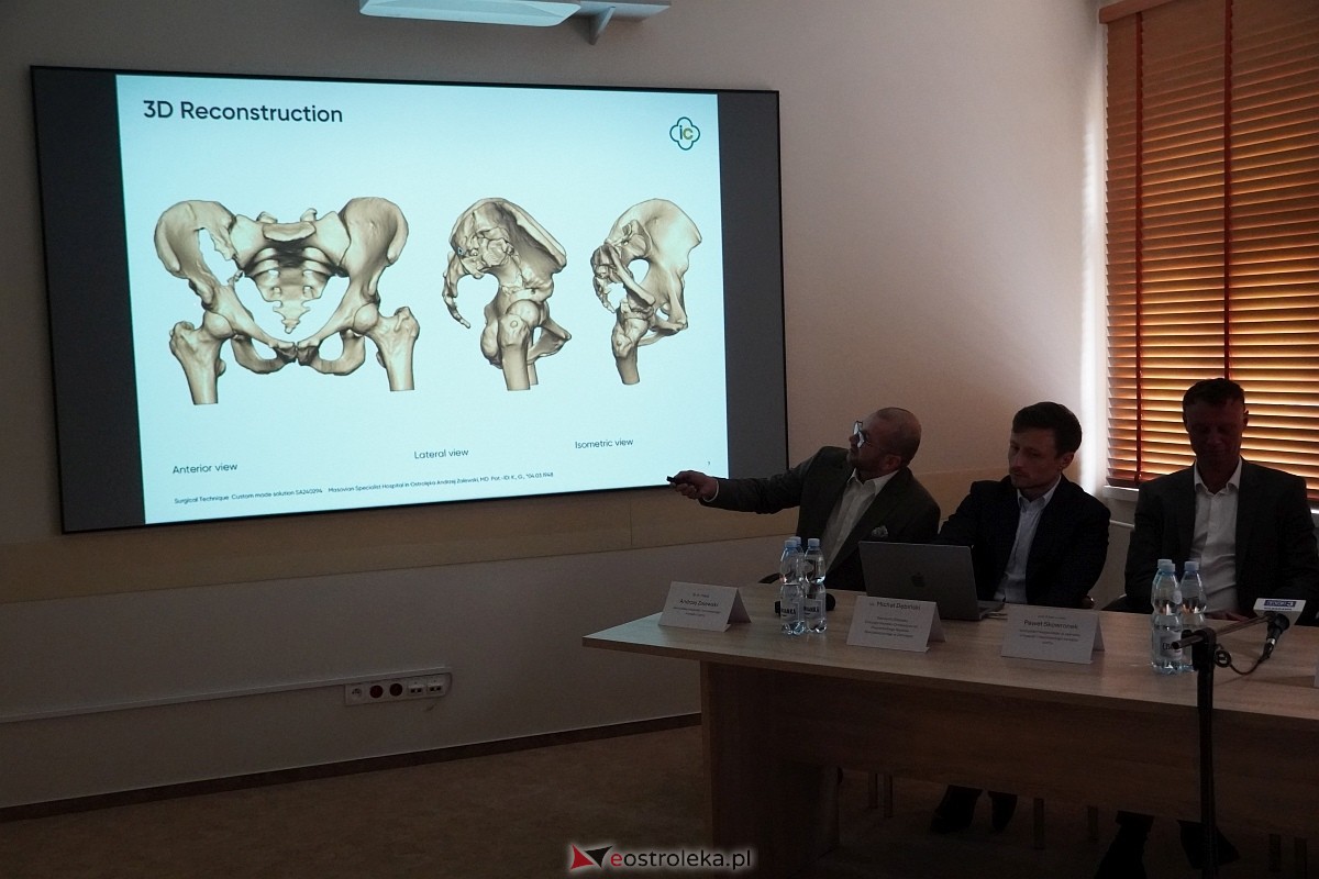 Nowatorski zabieg w ostrołęckim szpitalu [28.10.2024] - zdjęcie #7 - eOstroleka.pl