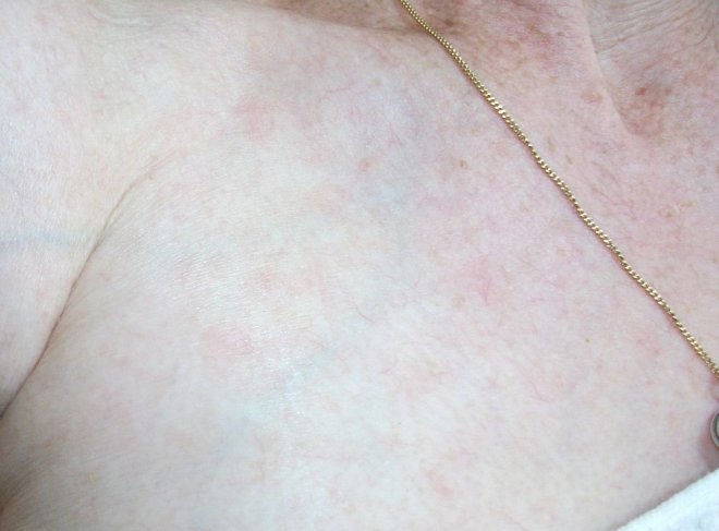 Laser dla zdrowia i urody [07.10.2014] - zdjęcie #32 - eOstroleka.pl